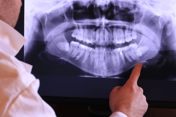 Best Dentist for Dental Trauma  in Ness City, KS
